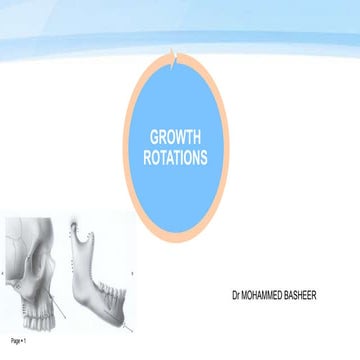 Growth rotations  in orthodontics
