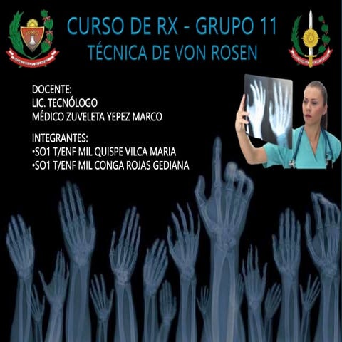 TECNICA DE VON ROSEN.pptx