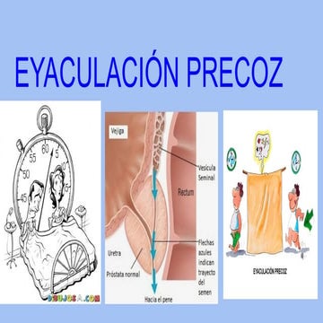 Grupo 3 Gametos y patologías