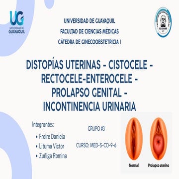 Cistocele | PPTX