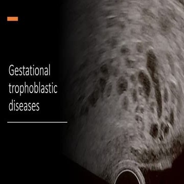 Molar pregnancy .pptx