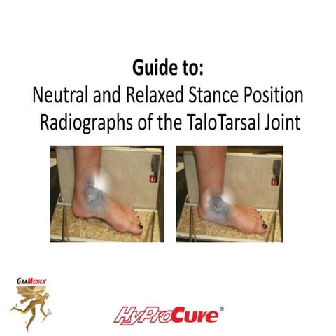 Neutral and Relaxed Stance X-ray Positioning for TaloTarsal Joint Dislocation
