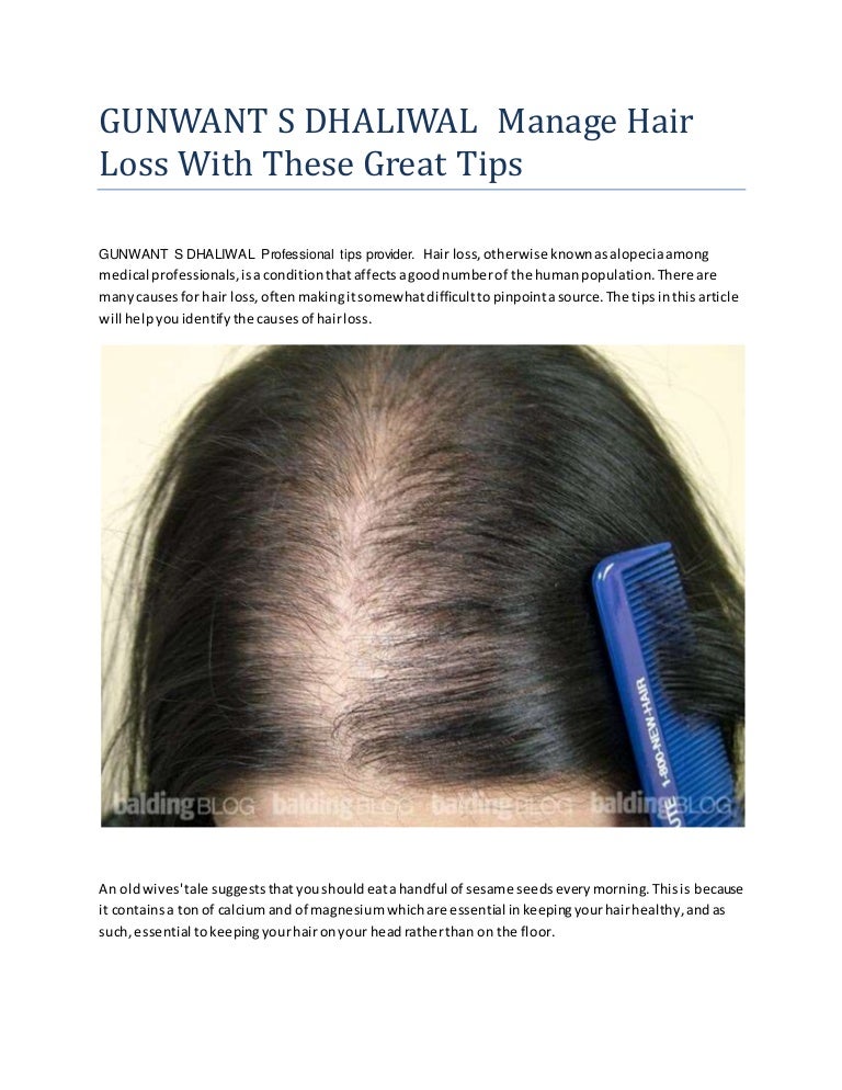Gunwant S Dhaliwal Manage Hair Loss With These Great Tips