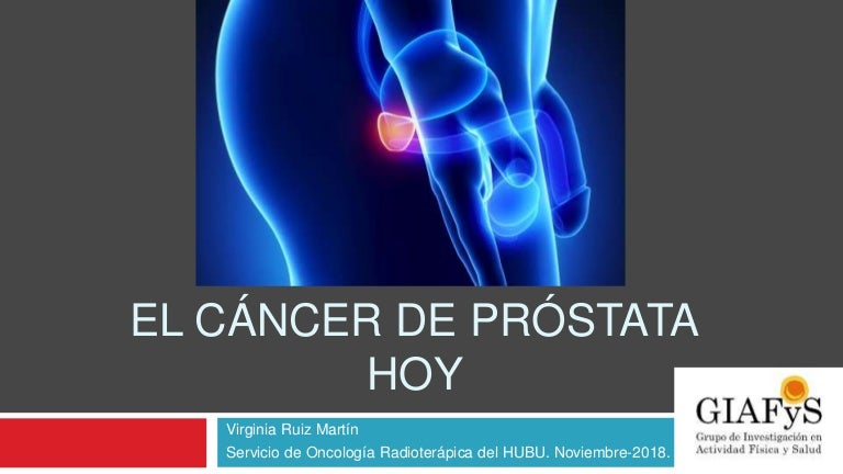 radioterapia curativa en cáncer de próstata