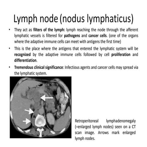 Histology and pathology of lymph nodes | PPTX