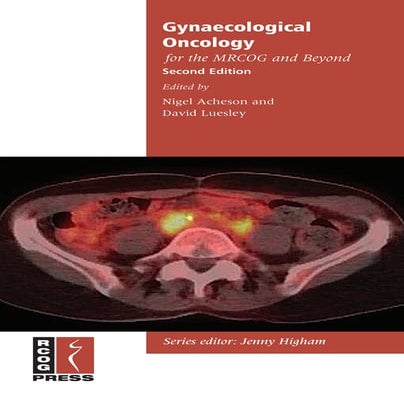 Gynaecological oncology for the mrcog and beyond, 2e 2