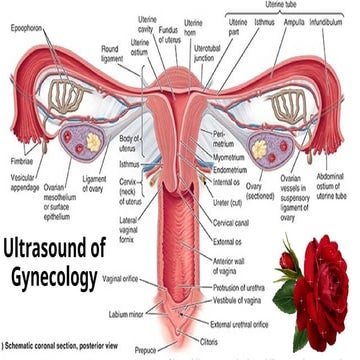 Ultrasound of gynecoloic pathologies.pptx