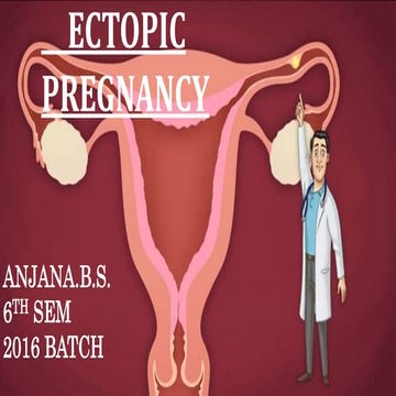 ECTOPIC PREGNANCY