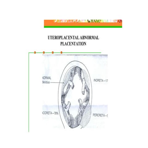 H:\Abnormal Implanataion[1]