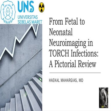 Congenital Torch in paediatric neurosurgery | PPTX