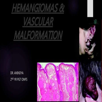 Haemangioma and vascular anomelies