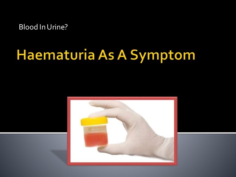 Haematuria as a symptom