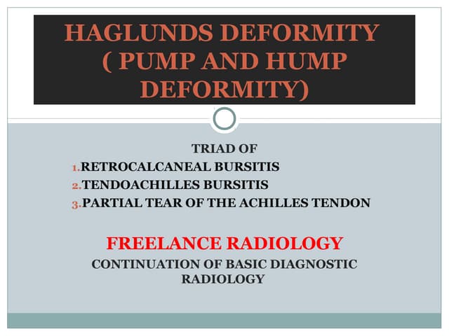 Haglunds deformity | PPT