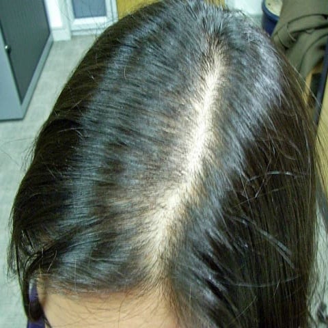 How to Grow Your Hair Quickly | PPT