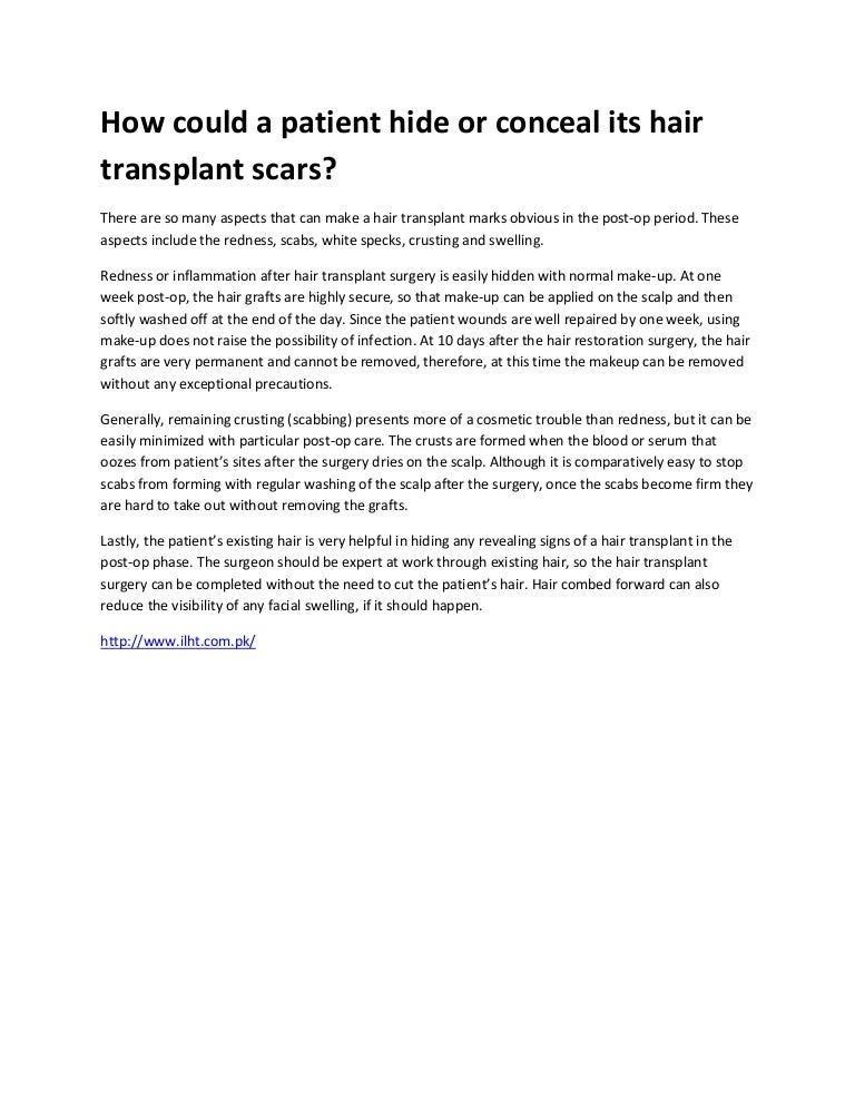 How Could A Patient Hide Or Conceal Its Hair Transplant Scars