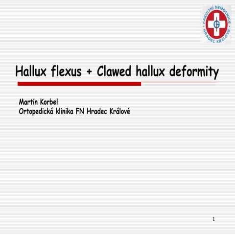 Hallux flexus + Clawed hallux