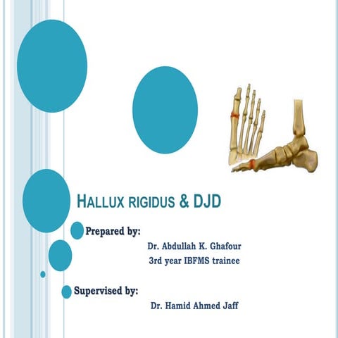 Hallux rigidus