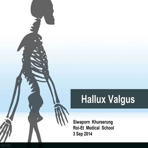 Hallux valgus.pptx