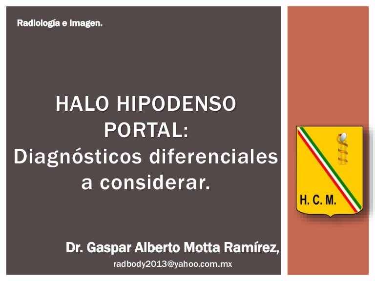 Hepatico edema periportal