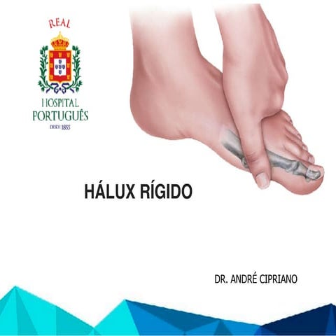 Fraturas diafisarias femur - AC | PPT