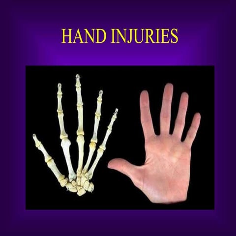 Hand injuries
