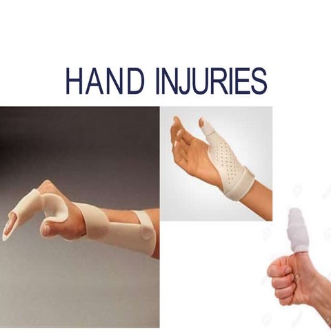 Hand injueirs.pptx