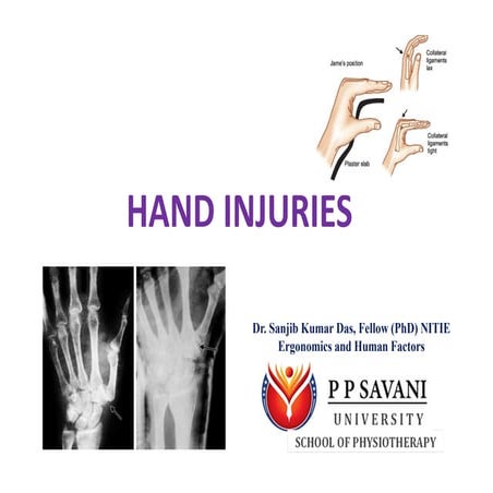 Hand injuries (compiled by Dr. Sanjib Kumar Das)