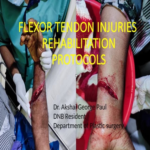 Hand Physiotherapy-RehabilitationAGP.pptx