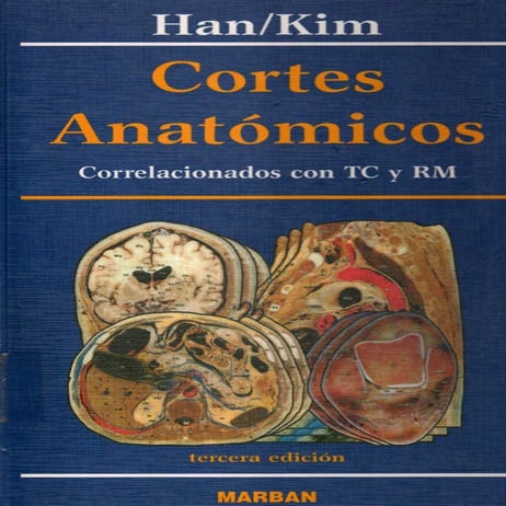Han kim cortes anatomicos correlacionados con tac y rm - cabeza y ...
