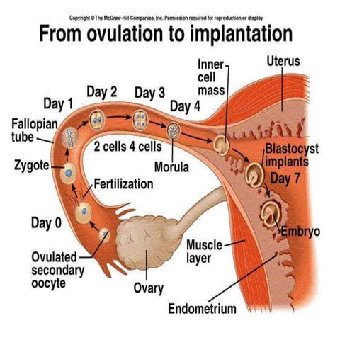 Multiple Pregnancy - Diagnosis ,Clinical Features & Complications | PPTX