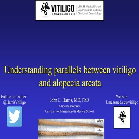 Understanding Parallels between Vitiligo and Alopecia Areata