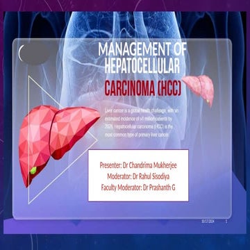 Principles of Management of Hepatocellular Carcinoma