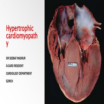 HCM Hypertrophic cardiomyopathy.pptx