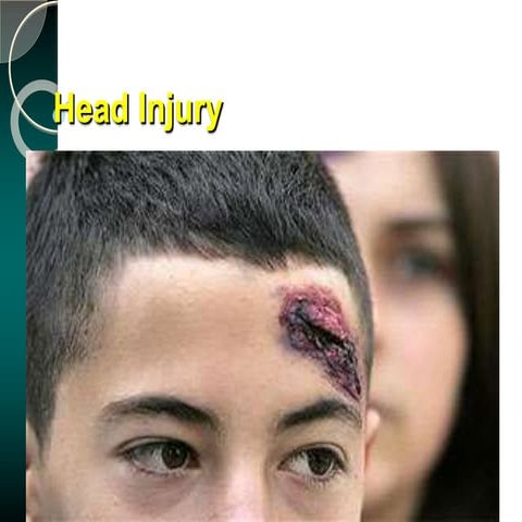 head-injury head injury HEAD INJURY .ppt