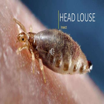 Head Lice (Louse)