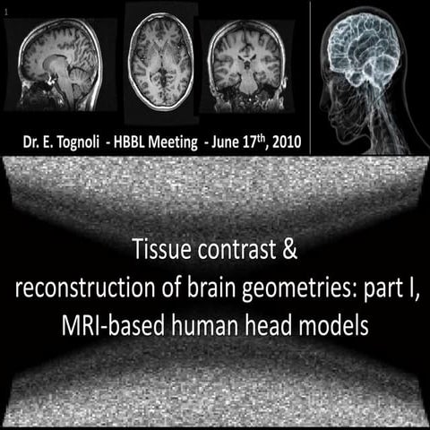 Tognoli: modeling head tissues to estimate sources