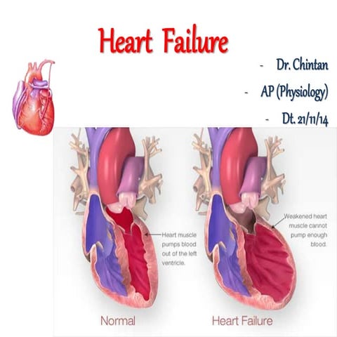 Heart  failure