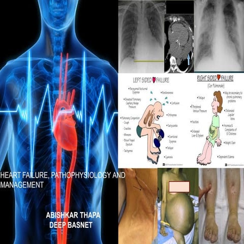 HEART FAILURE.pdf IS AVIALABE HERE AND DOWLOD IT FRMM HERE