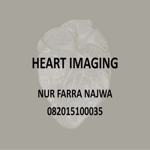 Heart imaging RADIOLOGY DEPT