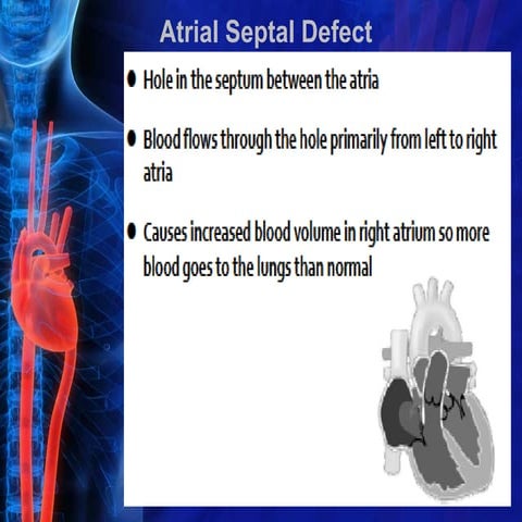 Stages of Dying from Congestive Heart Failure