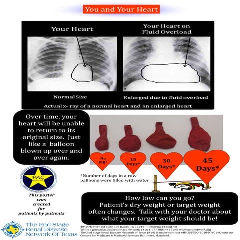 Heart poster | PDF