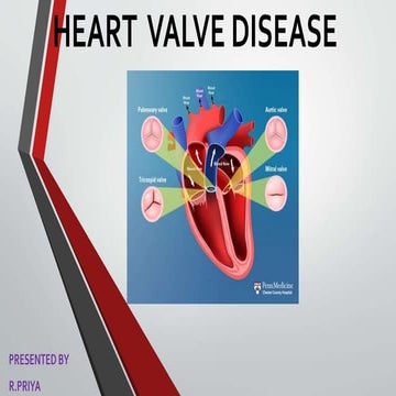 Heart valve disease