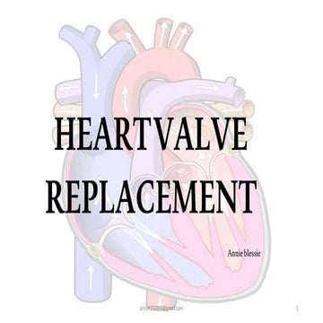 heart valve replacement.pptx