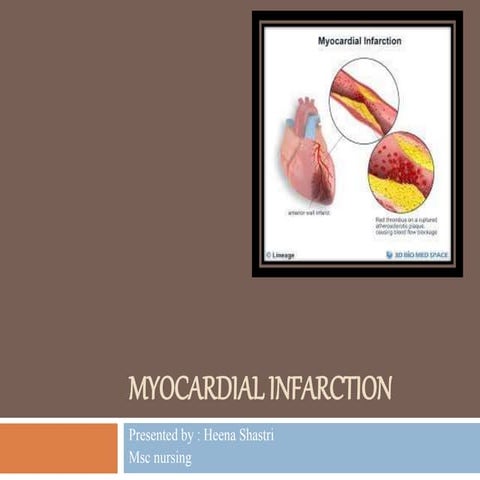 Mayocardial infarction 