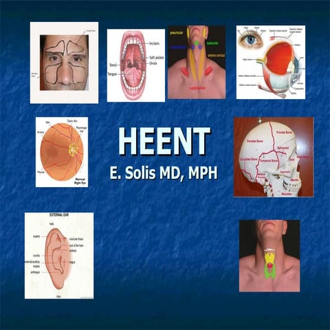 heent-091126080014-phpapp02.pdf