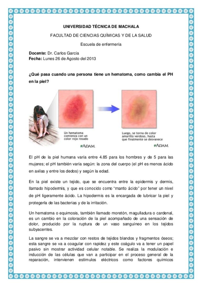 Cara vaso de sanguíneo ruptura la un en