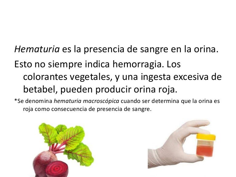 Semiología de la Hematuria