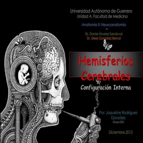 Hemisferios Cerebrales y Áreas Corticales