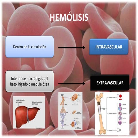 Hemolisis