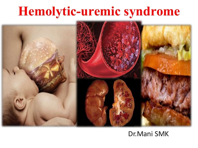 Hemolytic uremic Syndrome